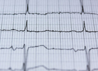 Ranking pulsometrów. Top 10 najlepszych modeli. Jaki wybrać?