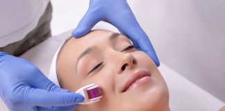 Mezoterapia igłowa – lifting bez skalpela?