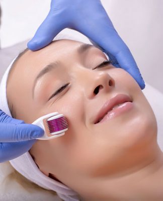 Mezoterapia igłowa – lifting bez skalpela?