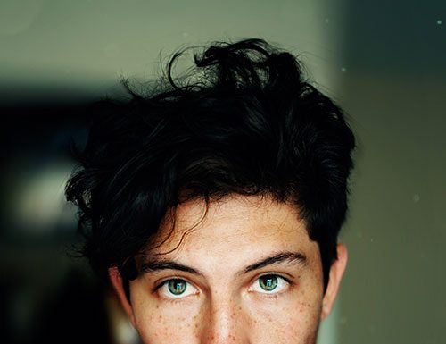 Gdy męskie włosy wymagają radykalnych środków, czyli krótki poradnik jak dbać o włosy, gdy matka natura nie obdarzyła nas gęstymi i mocnymi kosmykami Mezoterapia skóry głowy z osoczem bogatopłytkowym